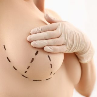 Patient during consultation for breast augmentation surgery.